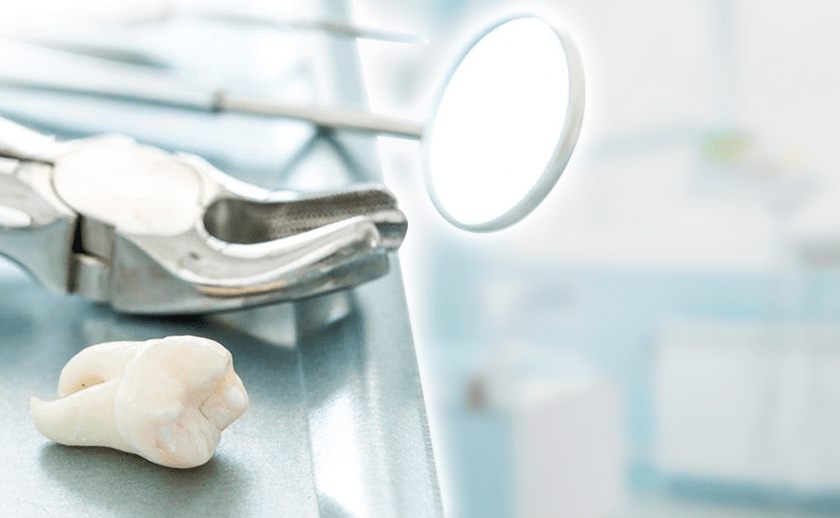 Удаление ретинированного зуба